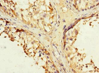 IFNLR1 Antibody