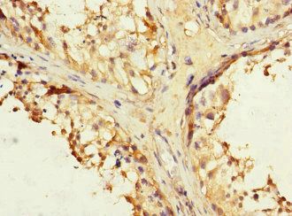 IFNLR1 antibody