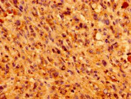 IFT46 Antibody