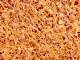 IFT46 antibody