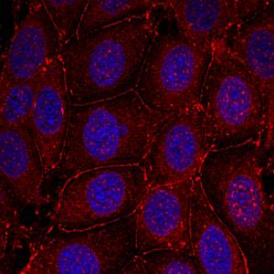 IGFR(Phospho-Tyr1161) Antibody