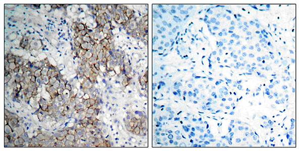 IGFR(Phospho-Tyr1161) Antibody