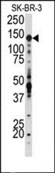 IGF1 Receptor antibody