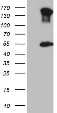 IGF1R Antibody
