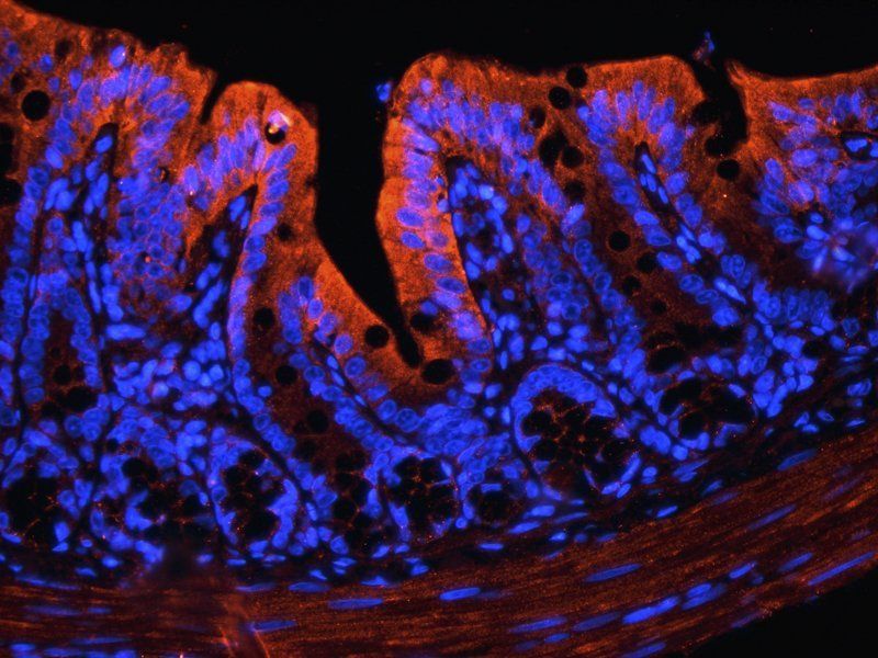 IGF1 antibody