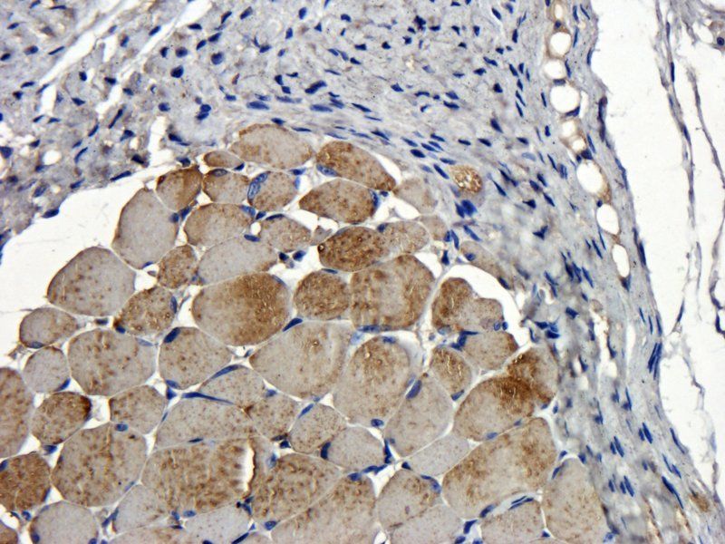 IGF1 antibody