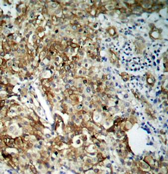 IGFR (Ab161) Antibody