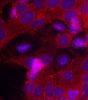 IGFR (Ab161) Antibody