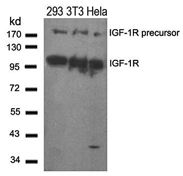 IGFR (Ab280) Antibody