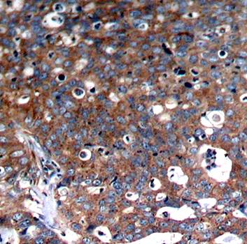 IGF-1R(Ab-1346) Antibody