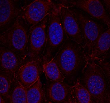 IGF-1R(Phospho-Tyr1165/Tyr1166) Antibody