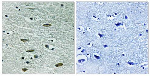 IGF1R (Ab-1346) Antibody