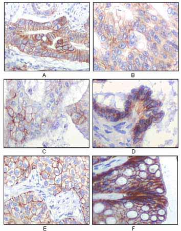 IGF1R-Beta Antibody