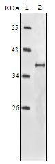IGF1R-Beta Antibody
