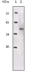 IGF1R-Beta Antibody