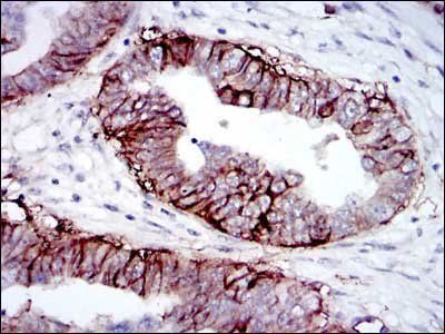 IGF1R-Beta Antibody