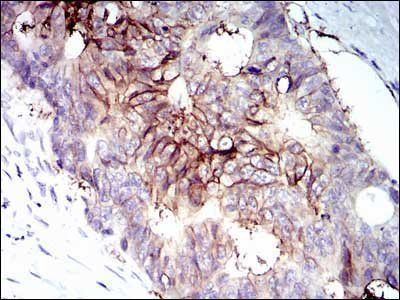 IGF1R-Beta Antibody