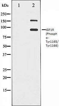 Phospho-IGF1 Receptor (Tyr1165/Tyr1166) Antibody