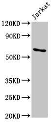IGF2BP1 Antibody