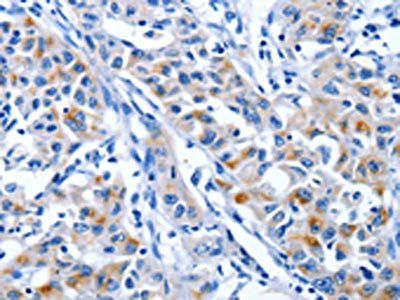 IGF2BP1 Antibody