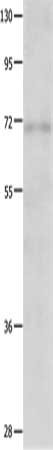IGF2BP1 Antibody