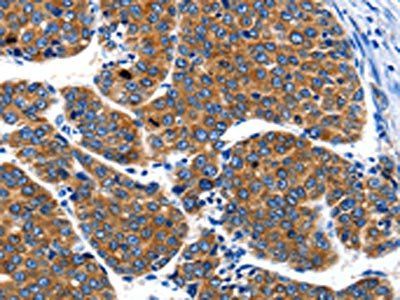 IGF2BP1 Antibody