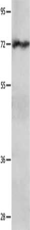 IGF2BP1 Antibody