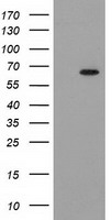 IGF2BP2 Antibody