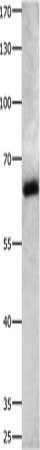 IGF2BP2 Antibody