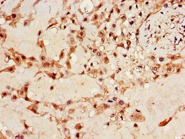 IGF2BP3 Antibody