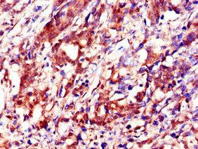 IGF2BP3 Antibody