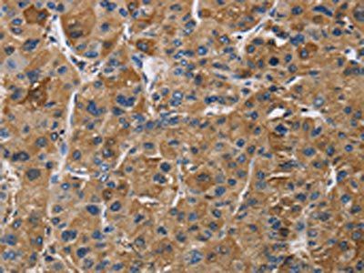 IGF2R Antibody