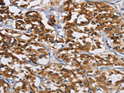 IGF2R Antibody