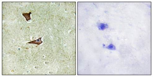 ECI1 antibody