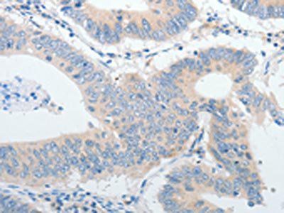 IGFBP1 Antibody