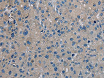 IGFBP1 Antibody