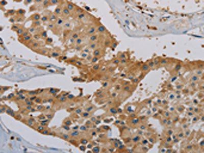 IGFBP1 Antibody