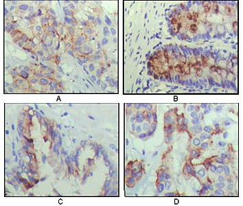 IGFBP2 Antibody