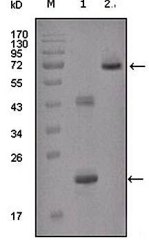IGFBP2 Antibody