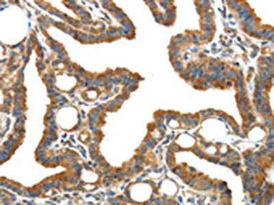 IGFBP3 Antibody
