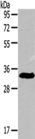 IGFBP3 antibody