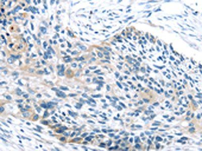 IGFBP3 Antibody