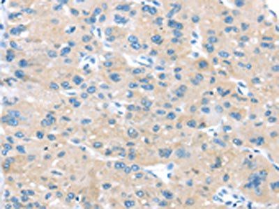 IGFBP3 Antibody