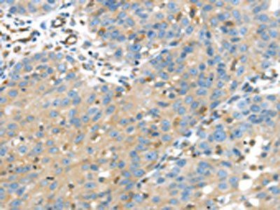 IGFBP4 Antibody