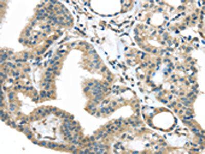 IGFBP4 Antibody