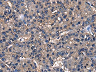 IGFBP5 Antibody