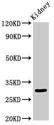 IGFBP7 Antibody