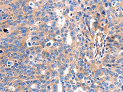 IGFBP7 Antibody