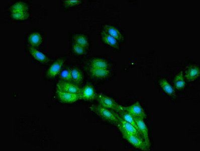 IgG R FcRn large subunit p51 antibody