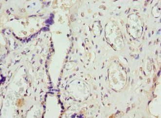 FCGRT Antibody